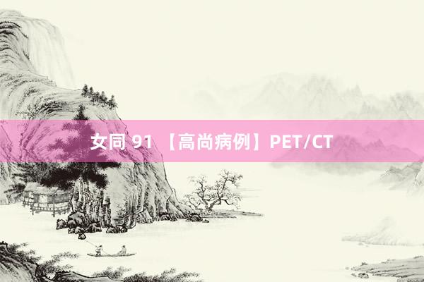 女同 91 【高尚病例】PET/CT